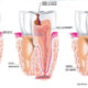 endodonzia